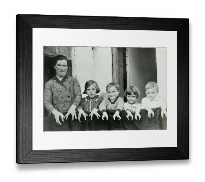 Framed Print : Mother and Children with Physical Abnormalities Framed Print : Mother and Children with Physical Abnormalities