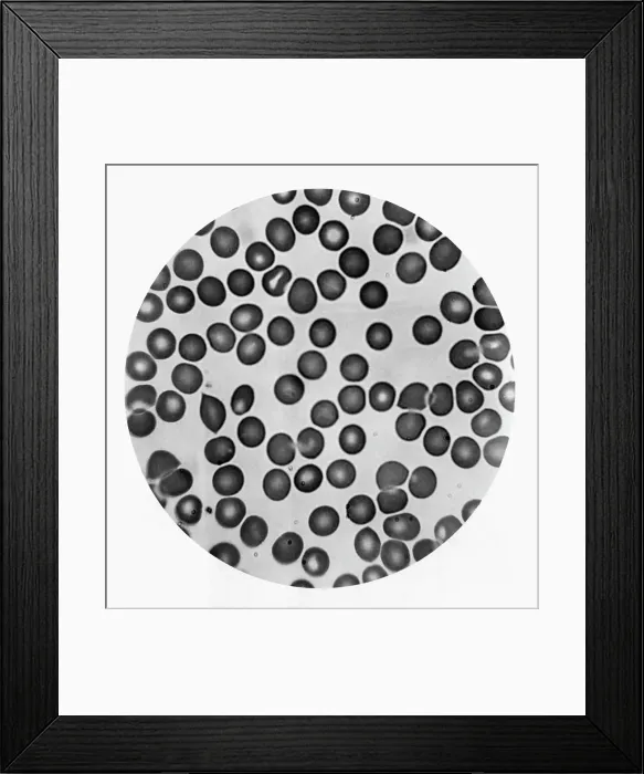 Framed Print : Microscopic View of Red Blood Cells Framed Print : Microscopic View of Red Blood Cells