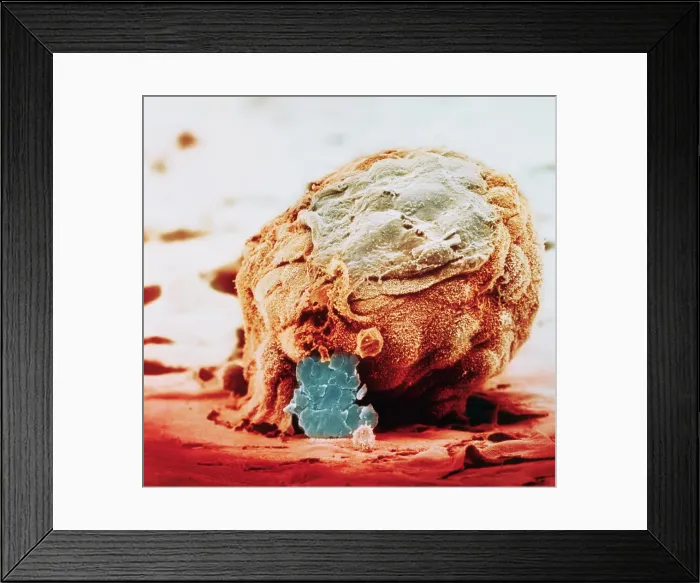 Framed Print : Human Embryo in Early Stages Framed Print : Human Embryo in Early Stages