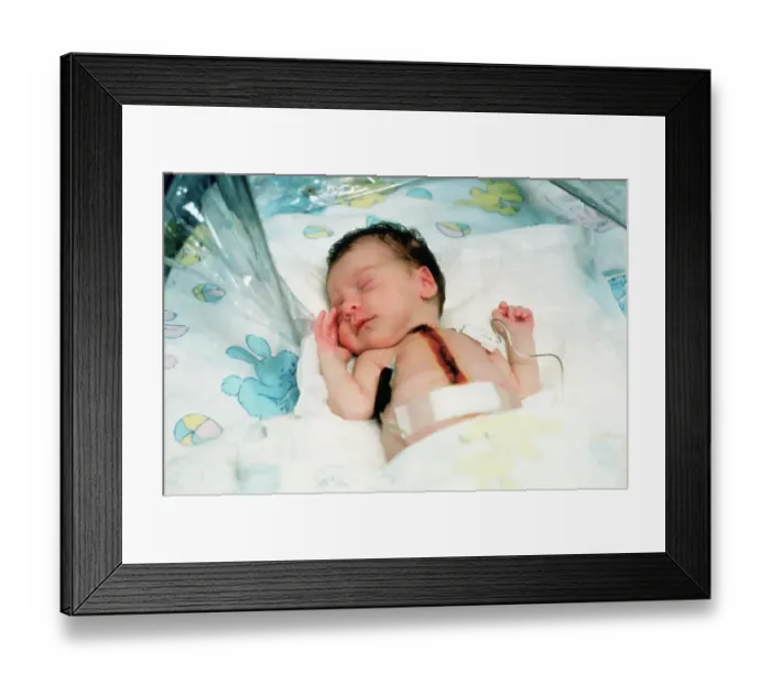 Framed Print : Baby Fae After Heart Transplant Framed Print : Baby Fae After Heart Transplant