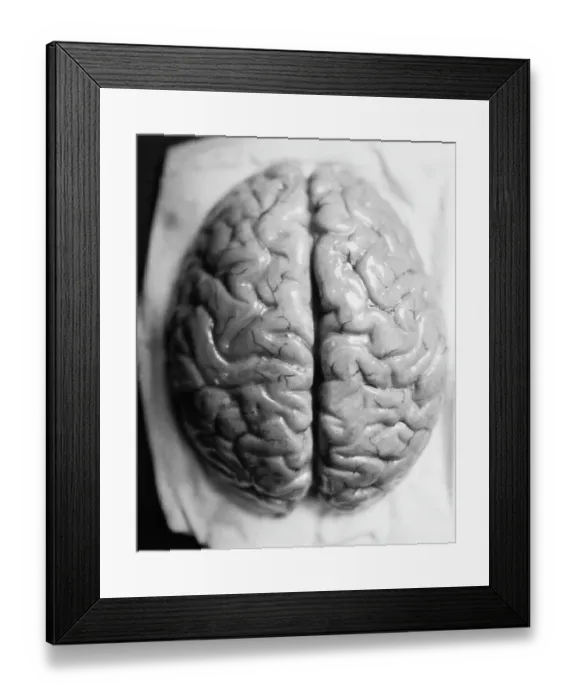 Framed Print : The Human Brain