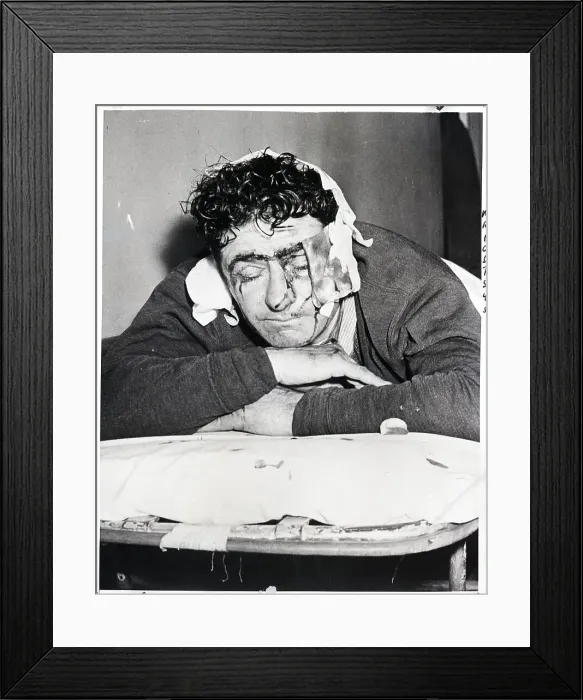 Framed Print : Bloody Policeman Lies On Gurney Framed Print : Bloody Policeman Lies On Gurney