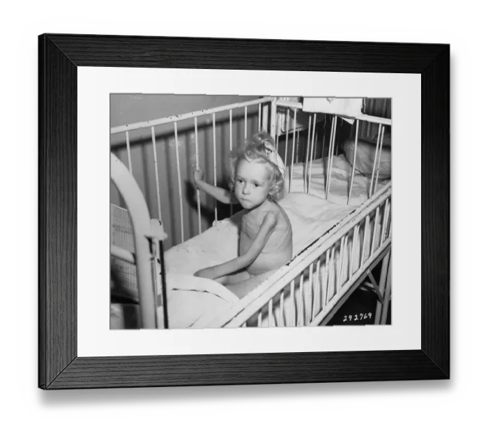 Framed Print : Starving German Child Framed Print : Starving German Child