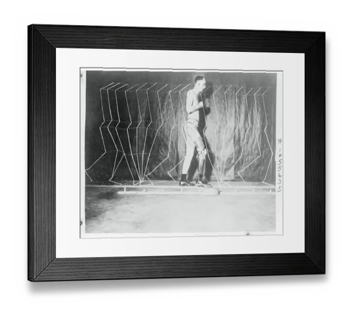 Framed Print : Howard D. Eberhart Demonstrating Prosthetic Movements Framed Print : Howard D. Eberhart Demonstrating Prosthetic Movements