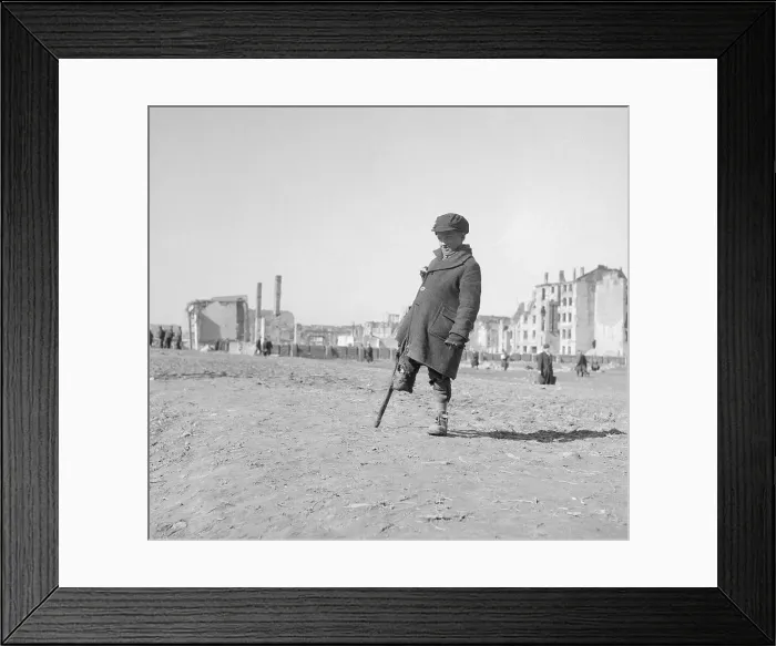 Framed Print : One Legged Boy Standing Amongst Ruins Framed Print : One Legged Boy Standing Amongst Ruins