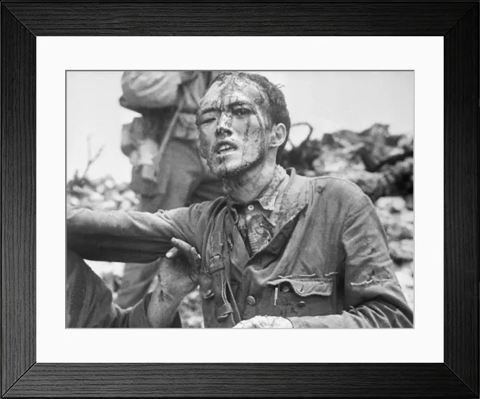 Framed Print : Japanese Soldier Injured and in Distress Framed Print : Japanese Soldier Injured and in Distress