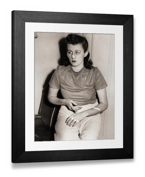 Framed Print : Woman with Cuts on Hand and Face