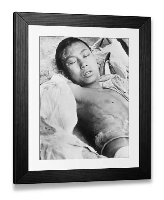 Framed Print : Wounded Young Chinese Machine-Gunner Framed Print : Wounded Young Chinese Machine-Gunner