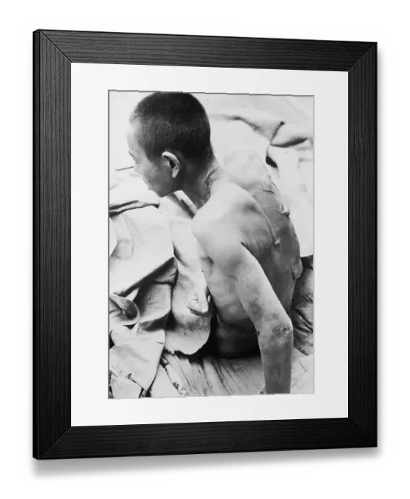 Framed Print : The Blistered Back of Young Wei Tso-Kan Framed Print : The Blistered Back of Young Wei Tso-Kan