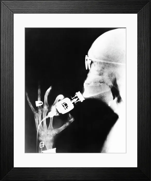 Framed Print : X-Ray Of Man Shaving With Electric Razor Framed Print : X-Ray Of Man Shaving With Electric Razor