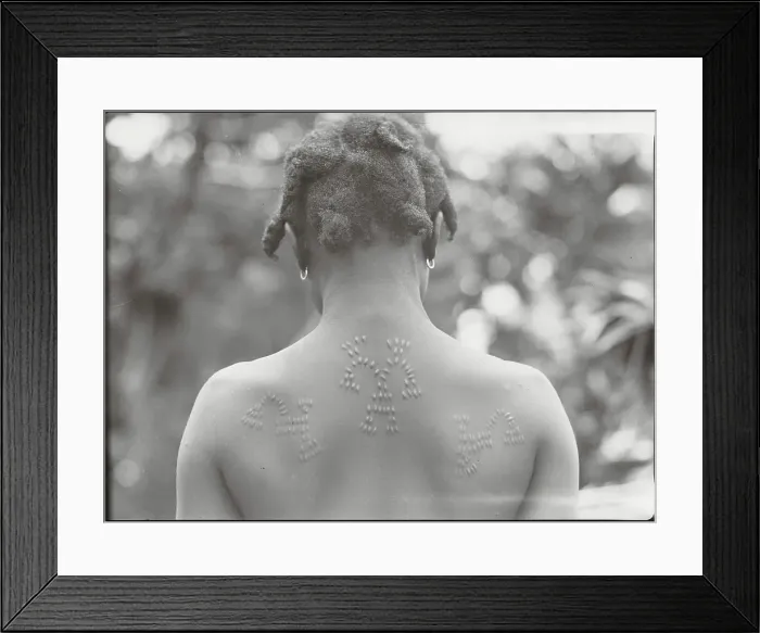 Framed Print : Ritual Scars on a Djuka's Back Framed Print : Ritual Scars on a Djuka's Back