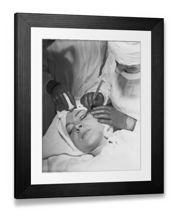 Framed Print : Surgeon Performing Eyelid Surgery on Woman Framed Print : Surgeon Performing Eyelid Surgery on Woman