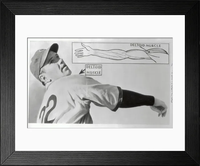 Framed Print : Graph of Jerome Dean's Arm Muscle Framed Print : Graph of Jerome Dean's Arm Muscle