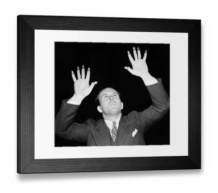 Framed Print : Dr. Irwin Moon with Thimbles on his Fingers