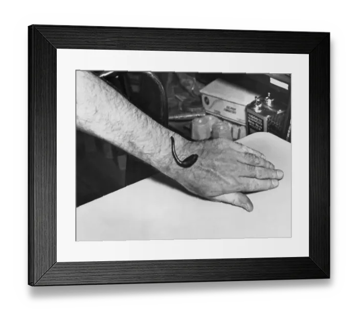 Framed Print : Man Receiving Help from Leech Framed Print : Man Receiving Help from Leech