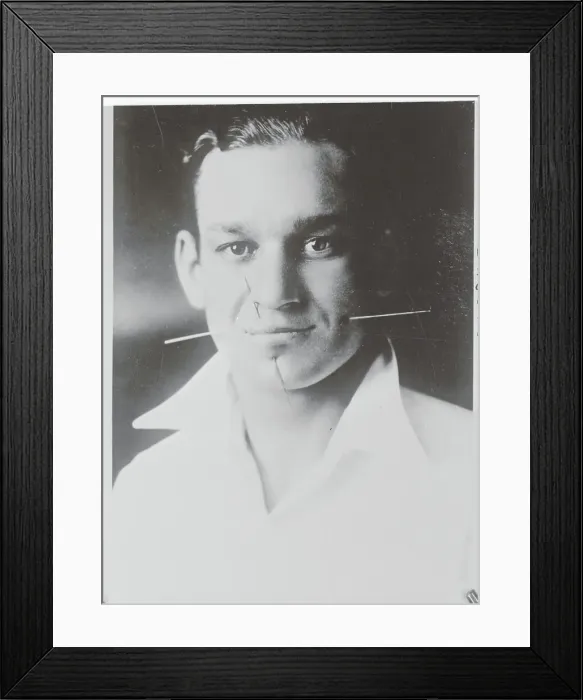 Framed Print : Man with Pins and Needles in Face Framed Print : Man with Pins and Needles in Face