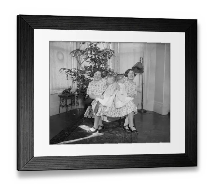 Framed Print : Siamese Twins Mary and Margaret Gibbs Framed Print : Siamese Twins Mary and Margaret Gibbs