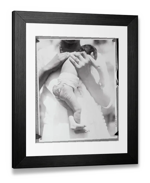 Framed Print : Baby Girl Born with Tail