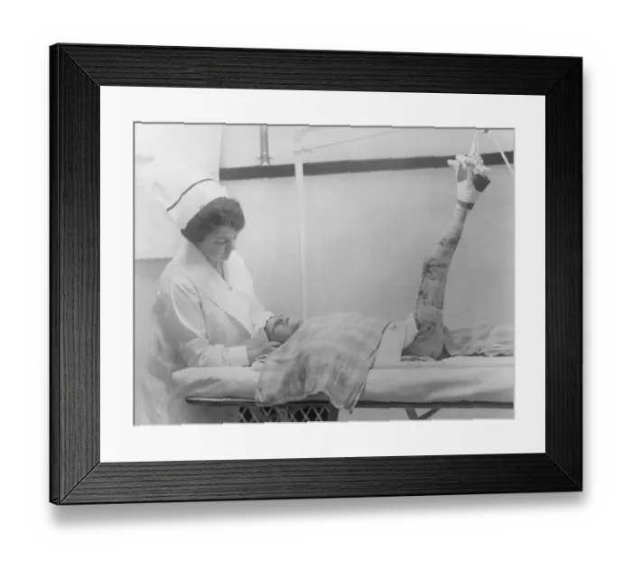 Framed Print : Boy After Skin Grafting Operation