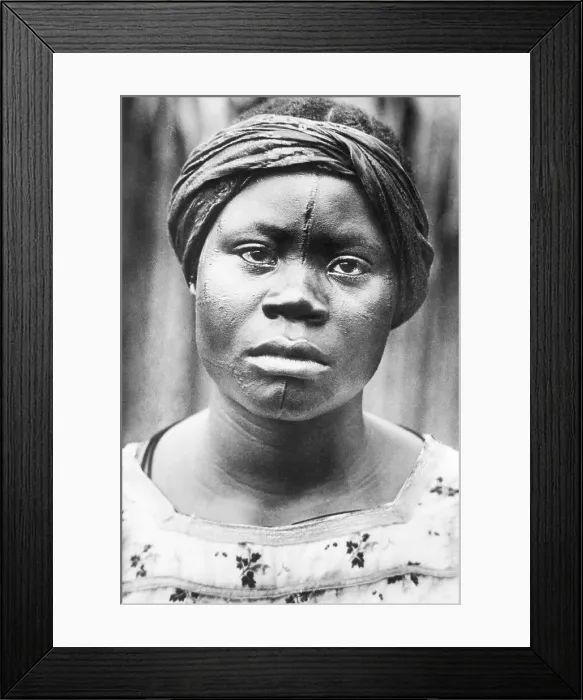 Framed Print : Woman Of Africa With Facial Scars Framed Print : Woman Of Africa With Facial Scars