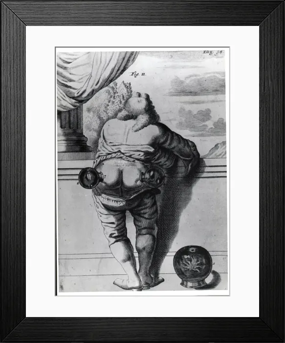 Framed Print : Man With Glass Tubes On Posterior;Engrav