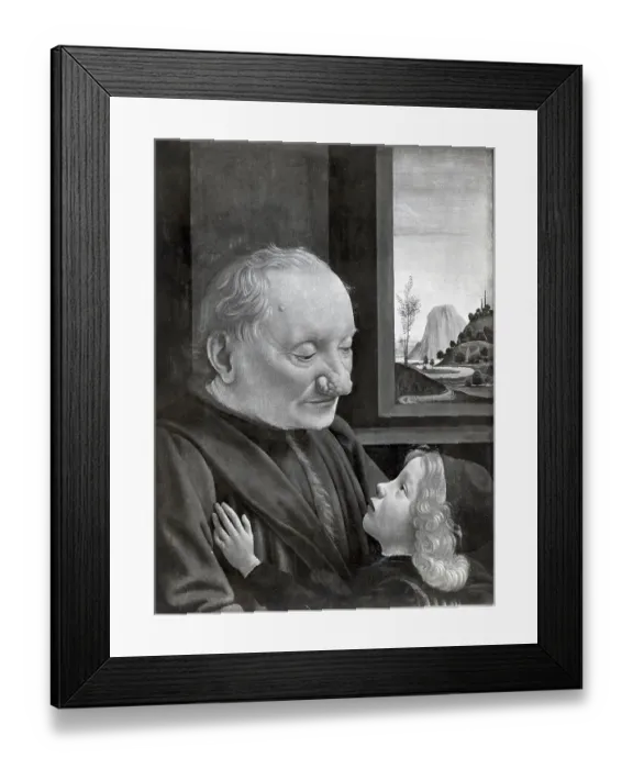 Framed Print : Portrait Of Man W / Nose Disease And Son Framed Print : Portrait Of Man W / Nose Disease And Son