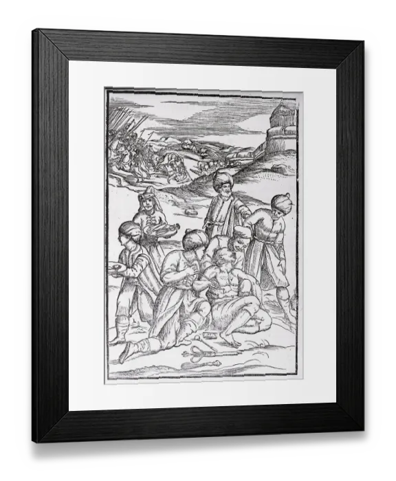 Framed Print : Woodcut of Doctor Cauterizing Wounded Soldier Framed Print : Woodcut of Doctor Cauterizing Wounded Soldier