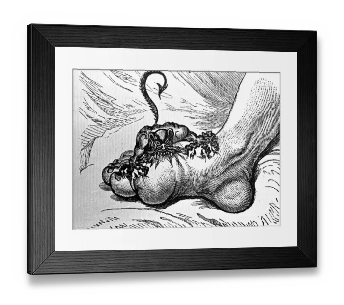 Framed Print : Drawing of The Gout, ca. 1799 Framed Print : Drawing of The Gout, ca. 1799