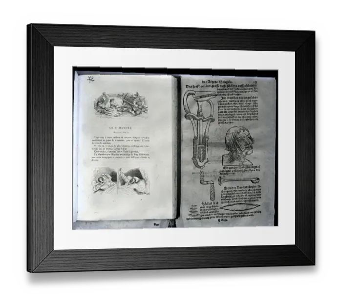 Framed Print : Band-Aid Over Gaping Wound Framed Print : Band-Aid Over Gaping Wound