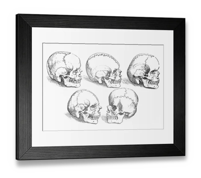Framed Print : Vesalius Engraving Of 6 Human Skulls Framed Print : Vesalius Engraving Of 6 Human Skulls