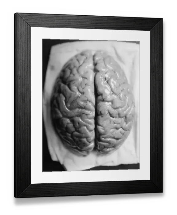 Framed Print : The Human Brain Framed Print : The Human Brain