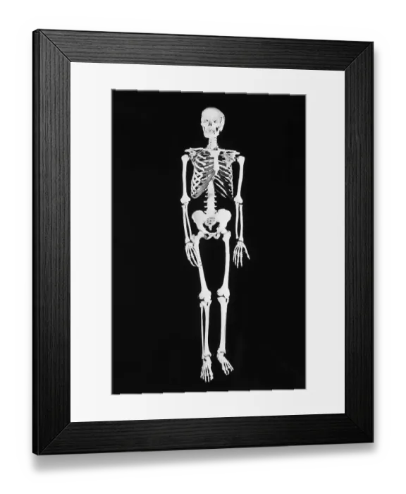 Framed Print : Skeleton On Black Background Framed Print : Skeleton On Black Background