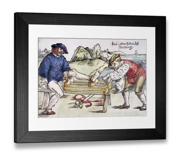Framed Print : Physician Setting Broken Knee Framed Print : Physician Setting Broken Knee
