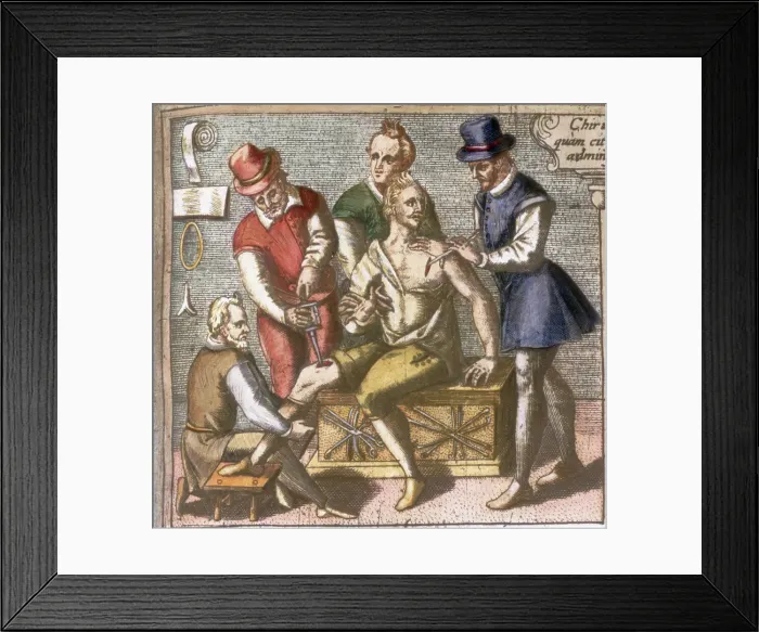 Framed Print : Copper Engraving of Surgical Procedures Performed on a Man's Shoulder and Leg Framed Print : Copper Engraving of Surgical Procedures Performed on a Man's Shoulder and Leg