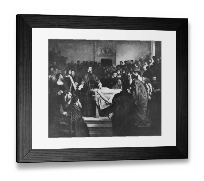 Framed Print : Painting Depicting Human Dissection Framed Print : Painting Depicting Human Dissection
