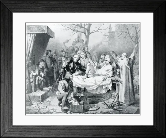 Framed Print : Painting of an Early Operation Framed Print : Painting of an Early Operation
