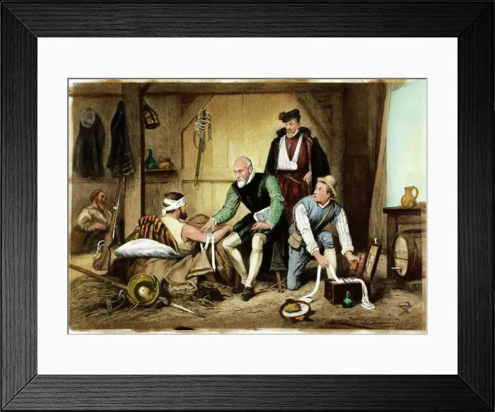 Framed Print : Ambroise Pare Treating Wounded Soldier Framed Print : Ambroise Pare Treating Wounded Soldier
