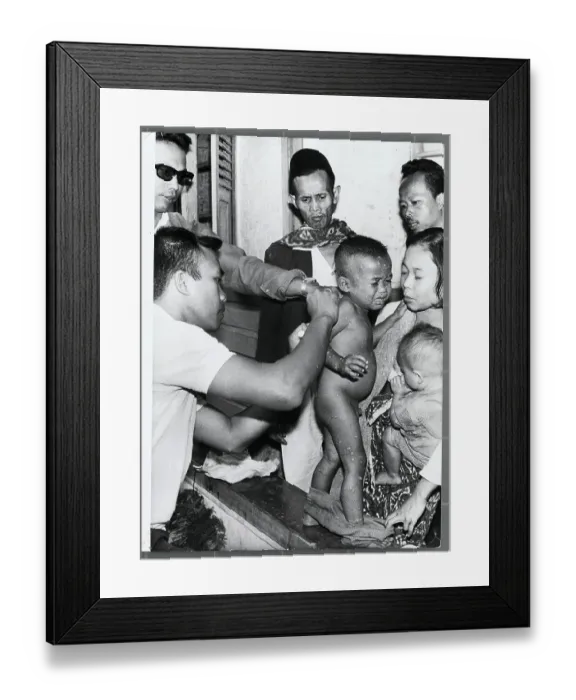 Framed Print : Child with Smallpox Crying Framed Print : Child with Smallpox Crying