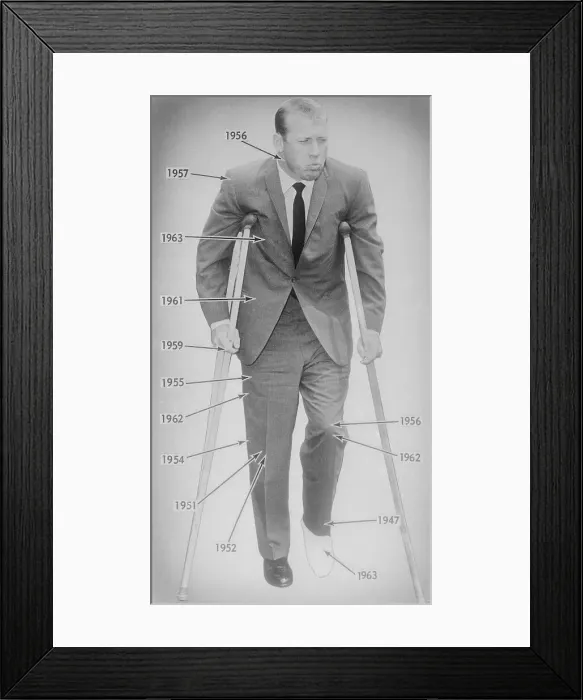 Framed Print : Mickey Mantle Standing with Crutches Framed Print : Mickey Mantle Standing with Crutches