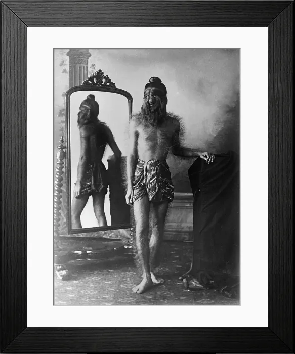 Framed Print : Hairy Man. (Original Caption). Full length standing portrait of Noung Phaset Framed Print : Hairy Man. (Original Caption). Full length standing portrait of Noung Phaset