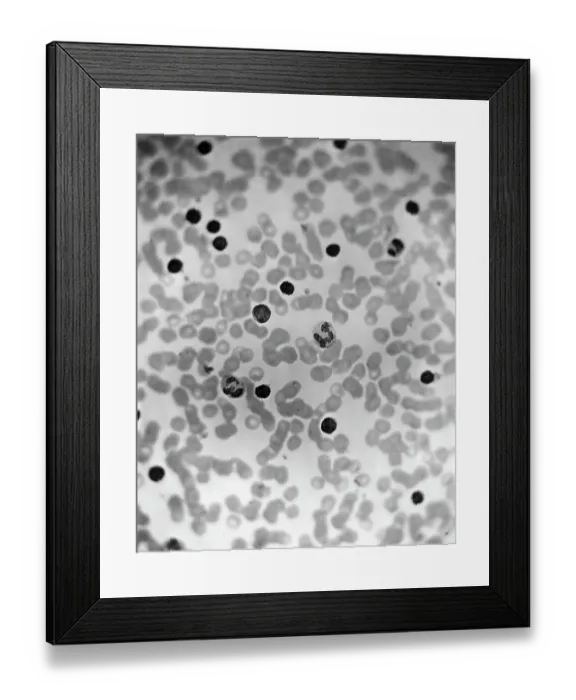 Framed Print : Microscopic View Of Human Blood Framed Print : Microscopic View Of Human Blood
