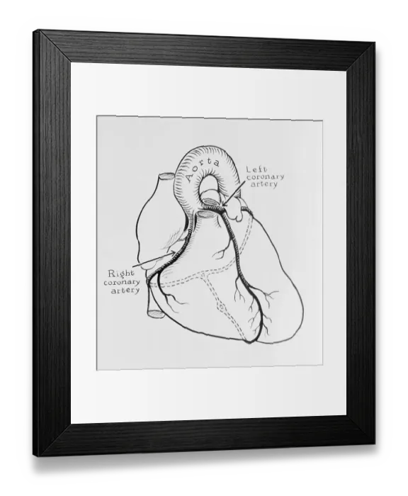 Framed Print : Heart Diagram