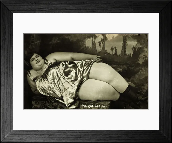 Framed Print : Obese Woman Lying On Chair Framed Print : Obese Woman Lying On Chair