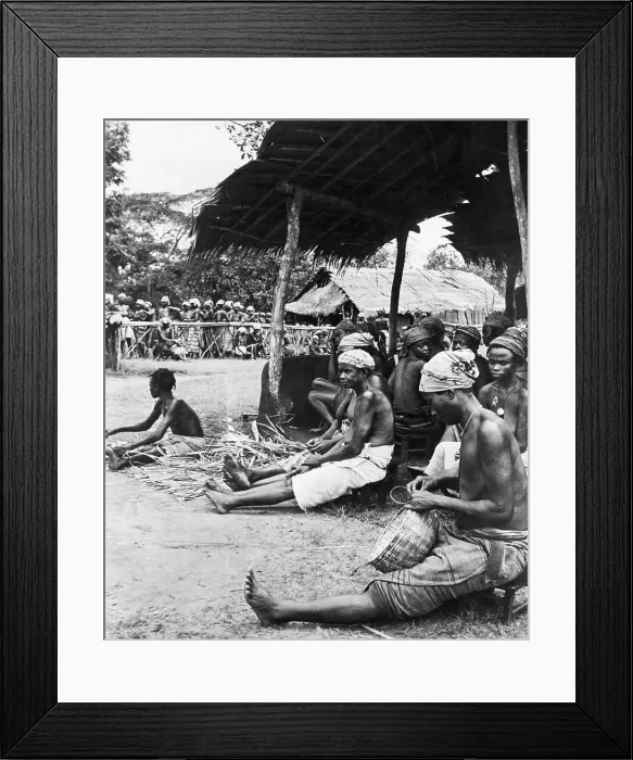Framed Print : Leper Colony in Africa Framed Print : Leper Colony in Africa