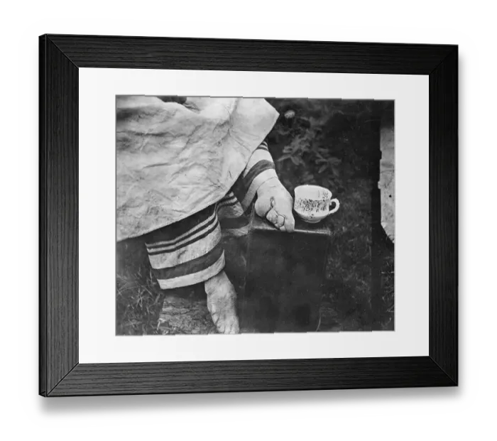Framed Print : Disfigured Result of Chinese Foot Binding Framed Print : Disfigured Result of Chinese Foot Binding