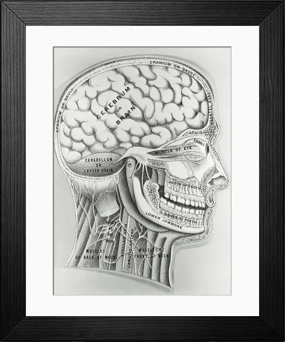 Framed Print : Cross Section Picture of the Human Brain Framed Print : Cross Section Picture of the Human Brain
