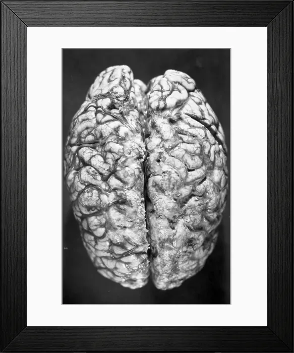 Framed Print : Top of Human Brain Framed Print : Top of Human Brain