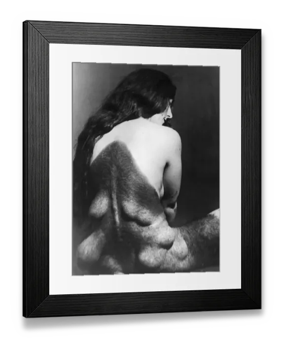 Framed Print : Woman with Glandular Problem: Female Gorilla