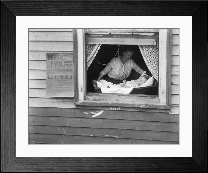 Framed Print : Child with Polio Sitting In Window