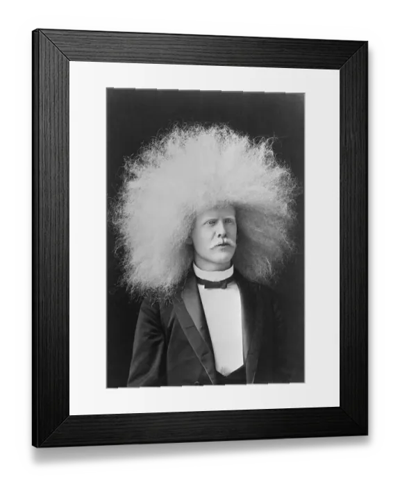 Framed Print : Unzie The Albino Framed Print : Unzie The Albino